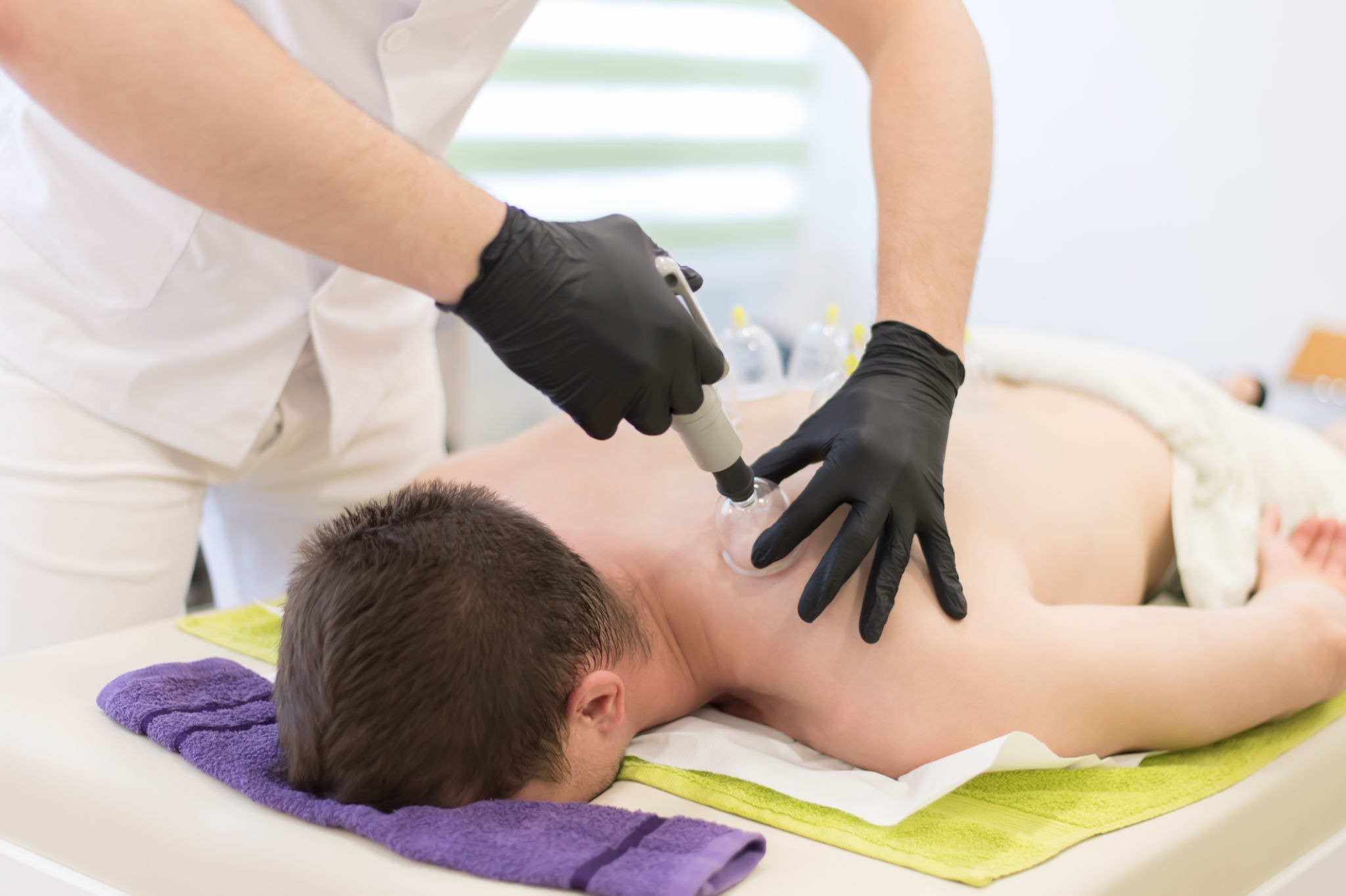 Les hadiths sur la Hijama
